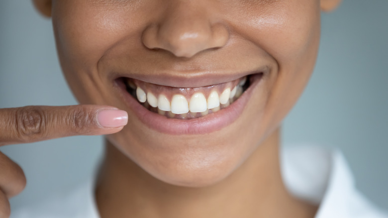 Closeup of someone pointing to their mouth while smiling widely