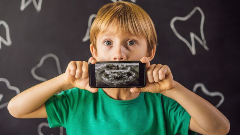 Kid holding an xray of his teeth